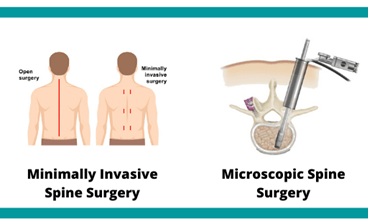 spine surgery